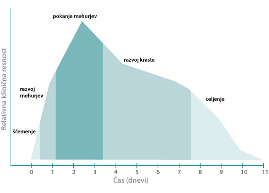 Stages of a fever blister outbreak